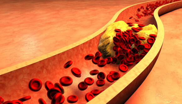 Як знизити рівень холестерину в крові: корисні поради