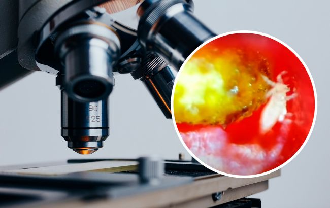 Видно, як рухаються. Вчені показали, скільки паразитів живе на популярній ягоді (відео)